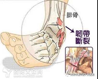 雁医技术一针见效一根银针为您解决疼痛烦恼